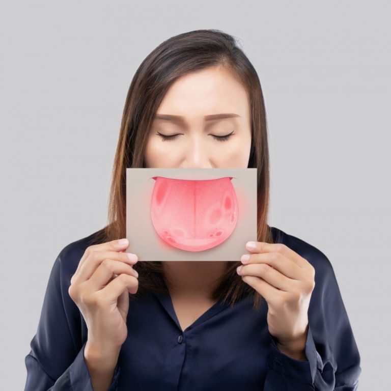 Oral Thrush Symptoms and what to do if you suffer from it? London