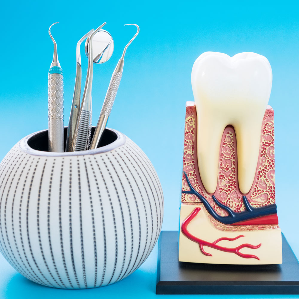 Emergency root canal treatment, London